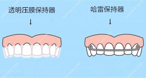 保持器还要单独算钱么?_还要计算器_计算器算钱