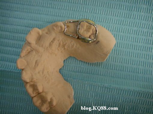 计算器算钱_保持器还要单独算钱么?_还要计算器